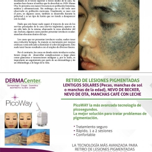  - peeling, microderoabrasion