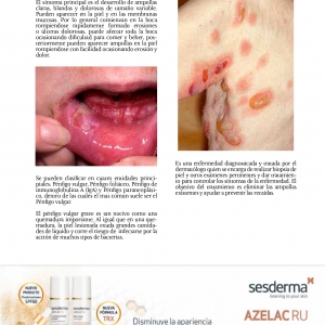  - luz pulsada intensa, dermatología
