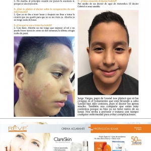 - microderoabrasion, m22