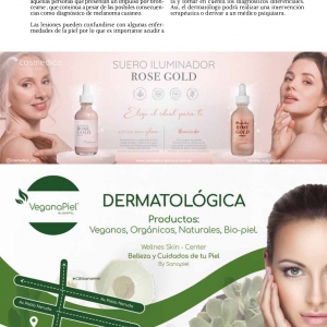  - láser co2 fraccionado, hollywood láser peel