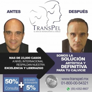  - resurfx, carboxiterapia
