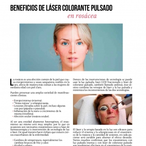  - ultherapy, laser colorante pulsado