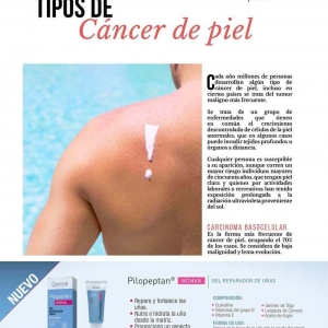  - tecnología laser, carboxiterapia
