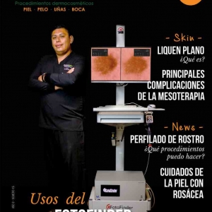  - retiro de lesiones pigmentadas, depilación masculina