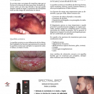  - dermatología, laser colorante pulsado