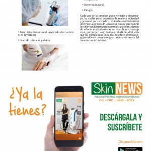  - carboxiterapia, light sheer