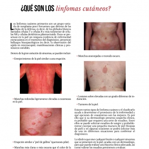  - retiro de lesiones pigmentadas,skinnews edicion 47