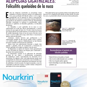  - microderoabrasion, radiofrecuencia