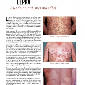  - exilis elite facial, rinomodelación