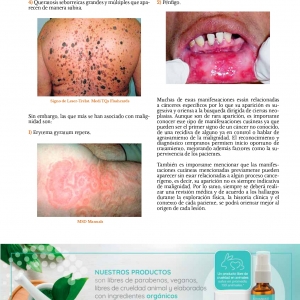  - láser co2 fraccionado, carboxiterapia