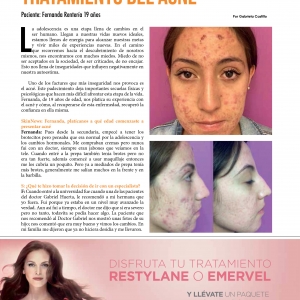  - retiro de tatuajes de todos los colores, tecnología laser