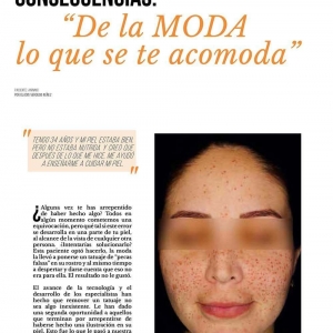  - luz pulsada intensa, cometica