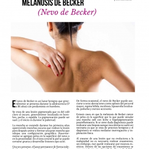 - cirugía dermatológica, tecnología láser diodo