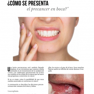  - cirugía dermatológica, láser para estrías