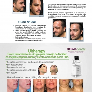  - retiro de lesiones pigmentadas, luz pulsada intensa