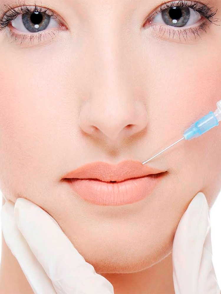 Rellenos de Labios y Cara