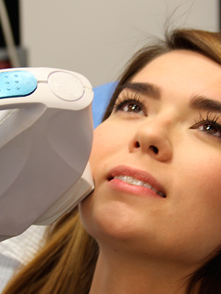 Luz Pulsada Intensa M22